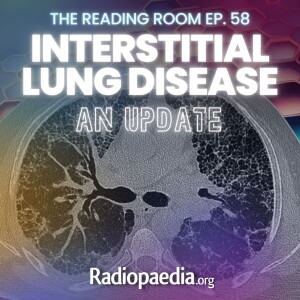 58. Lung HRCT update with Miranda Siemienowicz, Jonathan Chung & Jeffrey Kanne