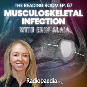 67. Musculoskeletal infection MRI nomenclature with Erin Alaia