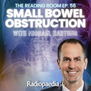 56. Readful! Small bowel obstruction with Michael Hartung