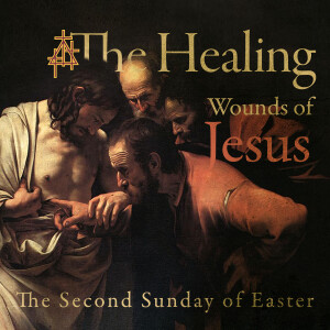 April 7, 2024. Divine Service. 8 A.M. | The Healing Wounds of Jesus |John 20:19-31| Jesus and Thomas