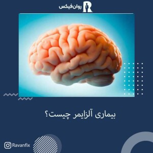 هر آنچه در مورد آلزایمر باید بدانید!