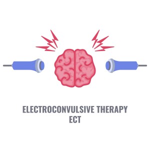 Electric Insights: Understanding Electroconvulsive Therapy (ECT) | Mind Matters | Palm Point Behavioral