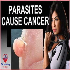 THEY KNOW:   PARASITES CAUSE CANCER