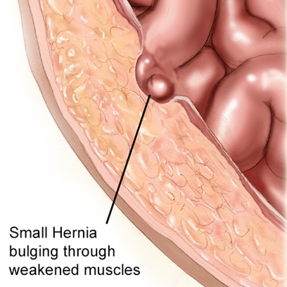 S02 E34 – Three Hernias and Nice Fingernails