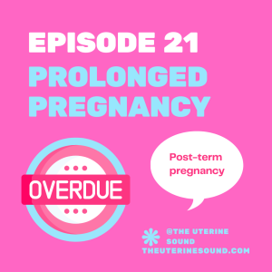 Episode 21: Prolonged Pregnancy