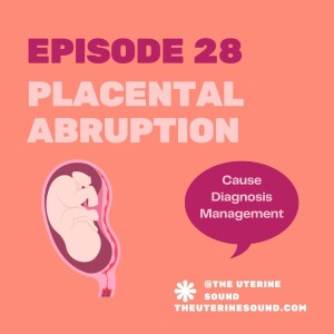 Episode 28: Placental Abruption