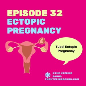 Episode 32: Ectopic Pregnancy