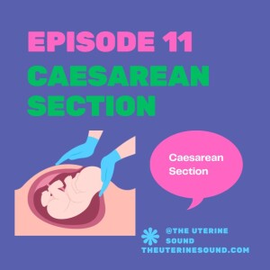 Episode 11: Caesarean Section (Part 1)