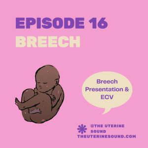 Episode 16: Breech Presentation and External Cephalic Version (ECV)