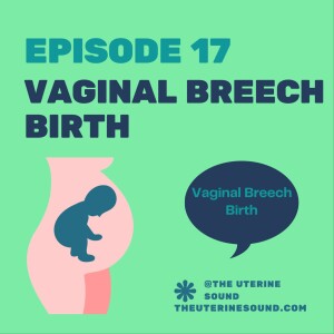 Episode 17: Vaginal Breech Birth