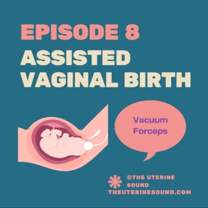 Episode 8: Assisted Vaginal Birth