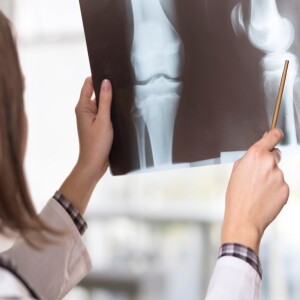 Fast Facts about Osteoporosis