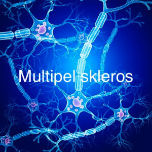 Multipel skleros