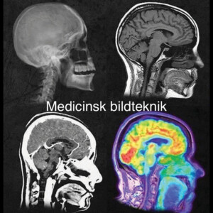 Medicinsk bildteknik