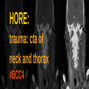 131. Craig Hore on Trauma and CTA of the Neck and Thorax