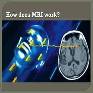 25. Interpretation of MRI in Critical Care by Nivene Saad