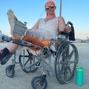 I Broke My Leg At Burning Man: The Brutiful Consequences of Ignoring My Intuition