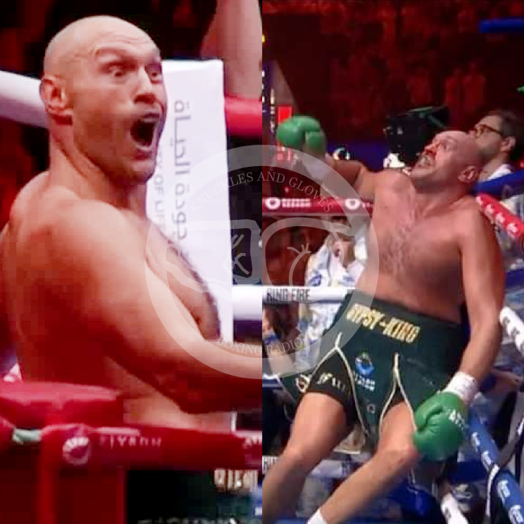 Knuckles and Gloves Boxing Radio