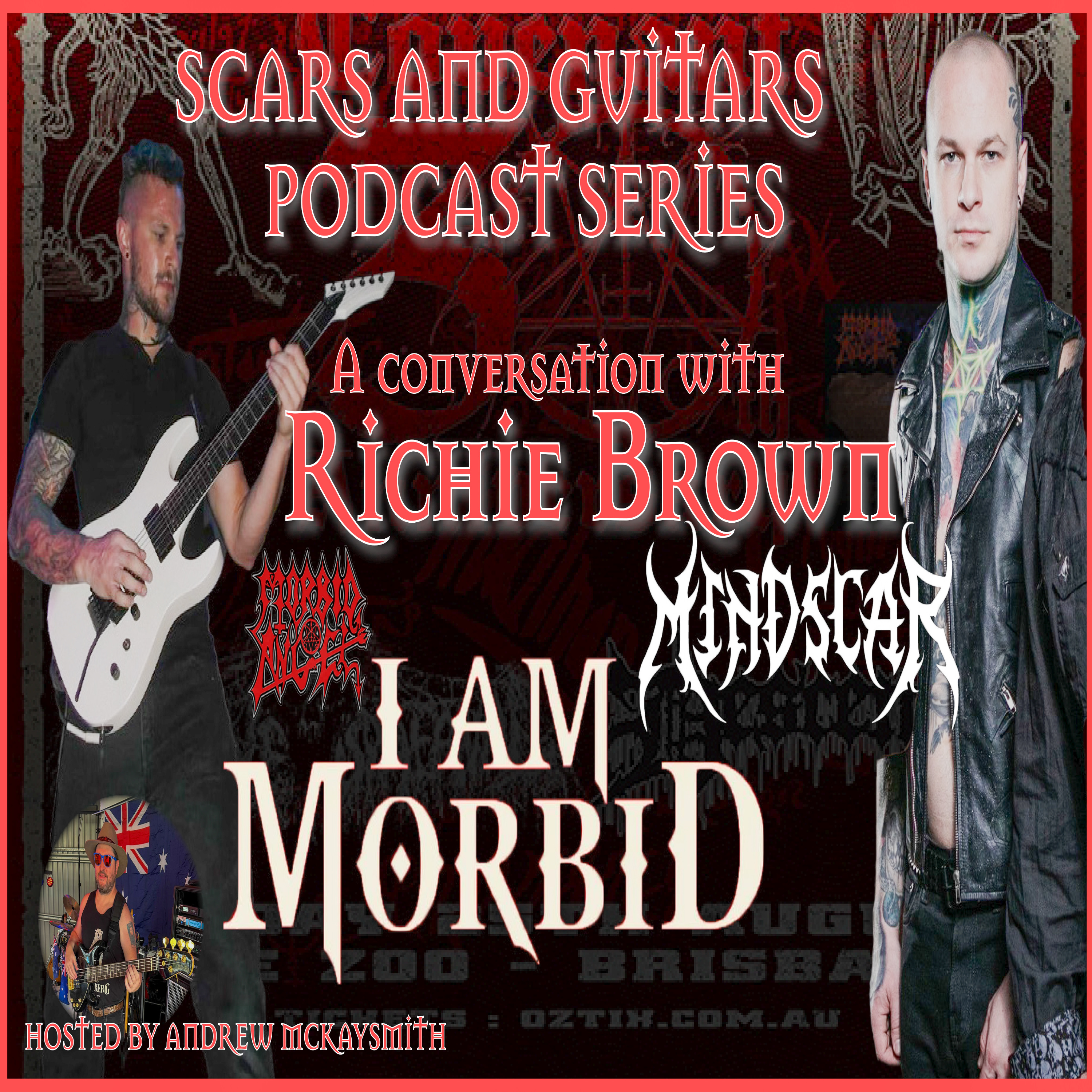 Scars and Guitars