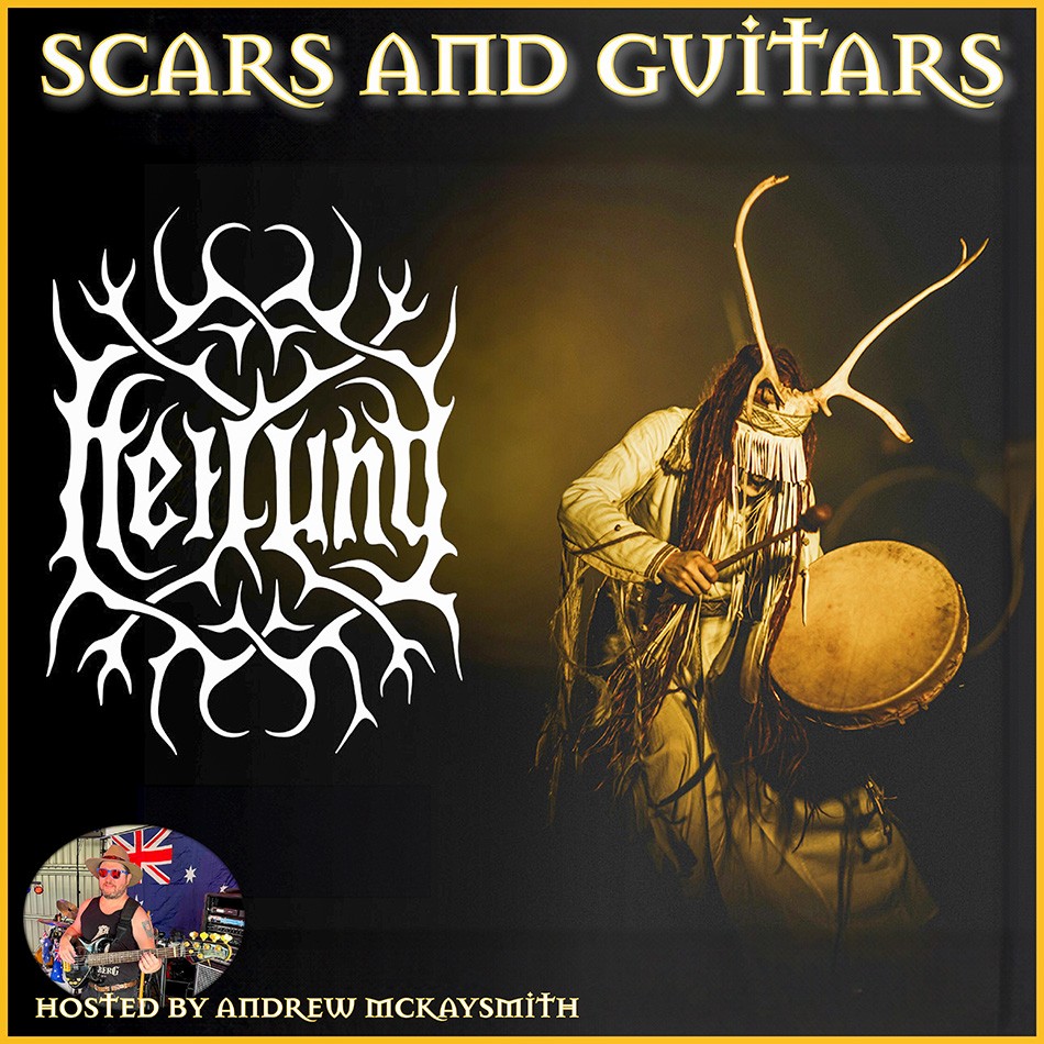 Scars and Guitars