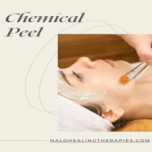 What Can a Chemical Peel Do for Your Complexion?