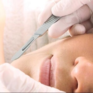 The Benefits of Dermaplane Facial Unlocking Smooth and Radiant Skin