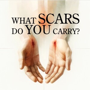 What Scars Do You Carry? - Overcome the Scar - Theresa Johnson - April 27, 2025