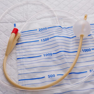 Stream A Professional Guide - How to Treat Catheter Problems?