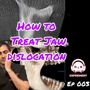 ep 003: How to Treat Jaw Dislocation Without Sedation