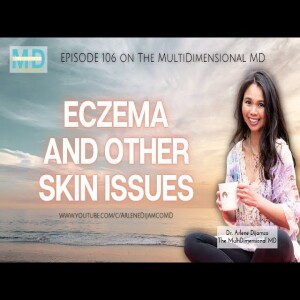 Ep. 106 - Eczema and other itchy skin issues - The MultiDimensional MD