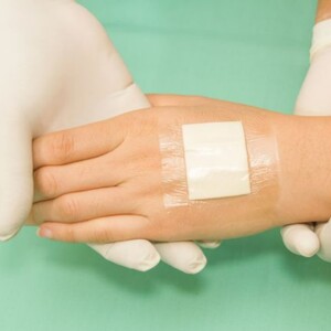 Mepitel One Silicone Wound Dressing: Effective and Reliable Care for Burns & Skin Tears