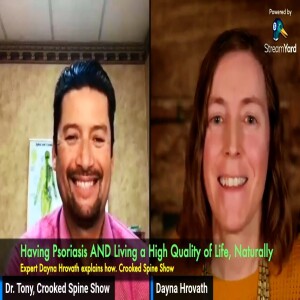 How to Live  with Psoriasis AND Have a  High Quality of Life, Naturally. Expert Dayna Hrovath explains how. Crooked Spine Show