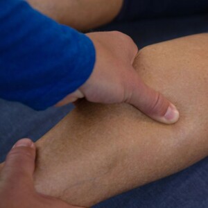 How Long Can You Live with Peripheral Artery Disease (PAD)?