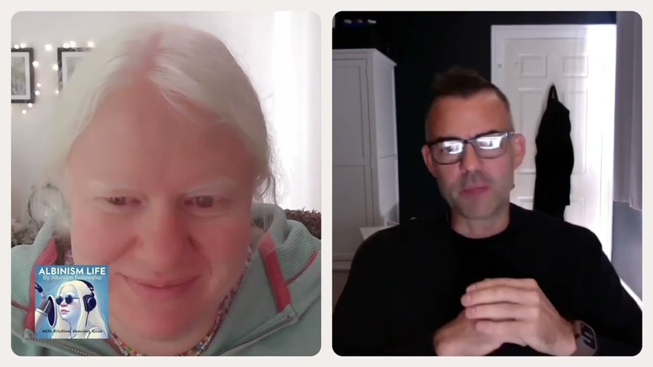 Albinism 101 – The basics of albinism