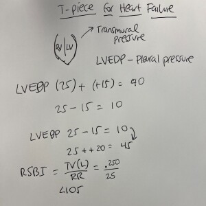 Extubation With T-Piece: When and Why