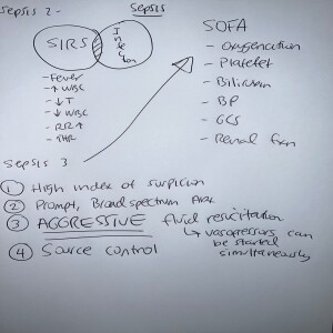 Lecture from the ICU: Sepsis