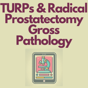 TURPs and Radical Prostatectomy - Prostate Anatomy and Gross Pathology