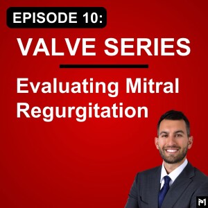 10. How to Evaluate Mitral Regurgitation (MR) - TEE for Mitral Valve Surgery
