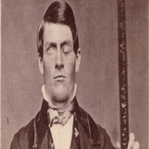 O Curioso Caso do Cérebro de Phineas Gage