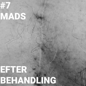 Afsnit 7 - Efter Behandling - Mads