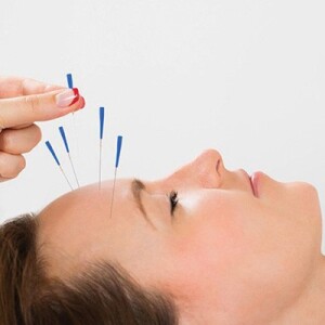 Stream_How Is Trigger Point Dry Needling Done By Professionals?