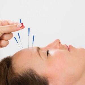 Efficacy of Trigger Point Dry Needling for Musculoskeletal Conditions
