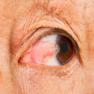 How Much Does Eye Laser Surgery Cost: Is It Worth It?
