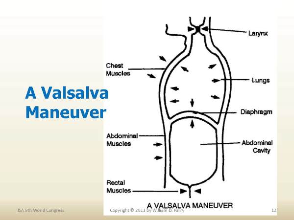 每日跟讀#706: Weightlifter’s temporary vision loss due to Valsalva phenomenon