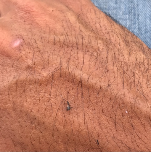 the bugs of sick