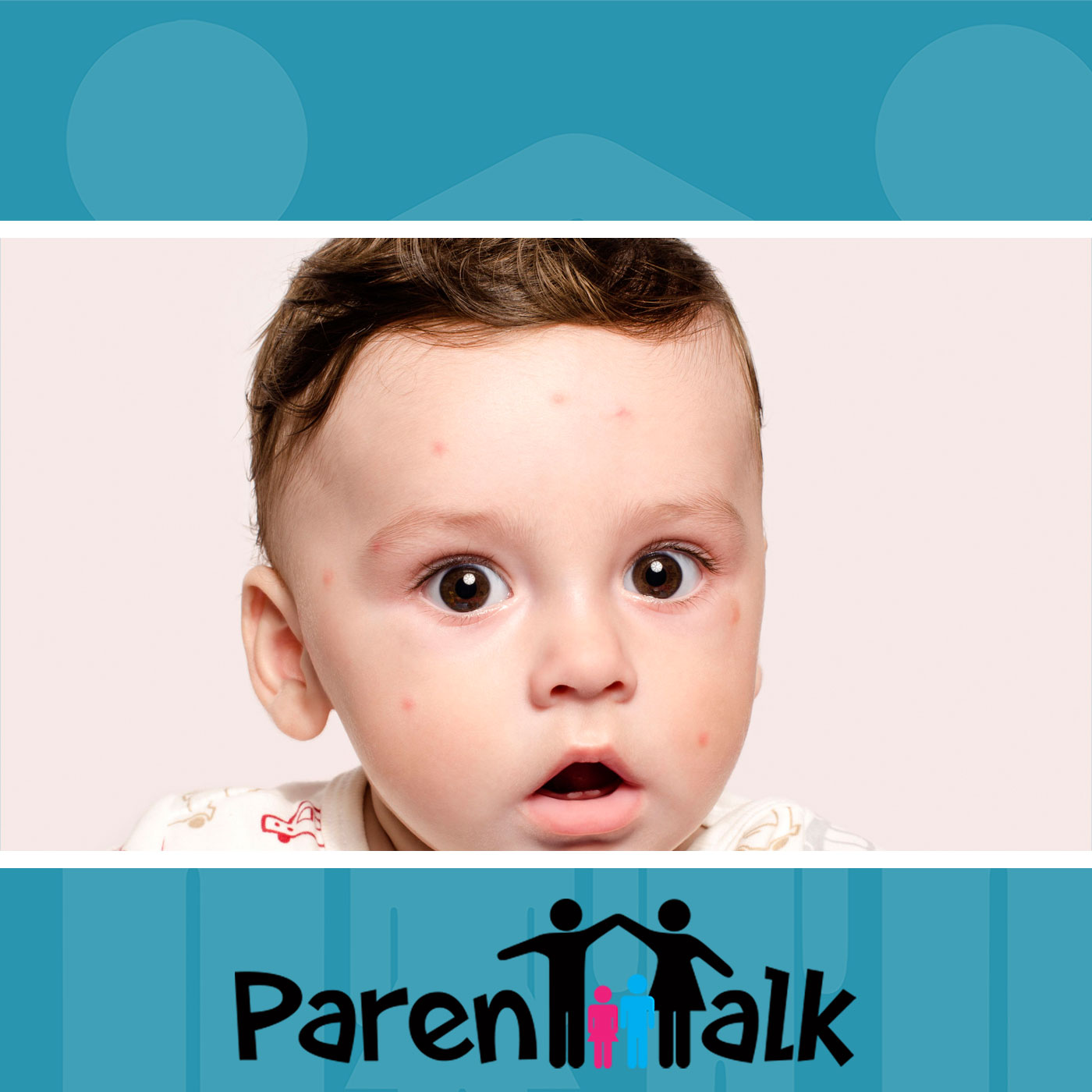 E15 – Common Children’s Skin Rashes with Dr. Sarah Walkun – Parent Talk ...