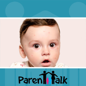 E15 - Common Children's Skin Rashes with Dr. Sarah Walkun - Parent Talk