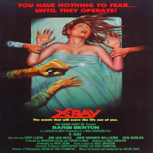 Episode # 156 - X-Ray (1981)