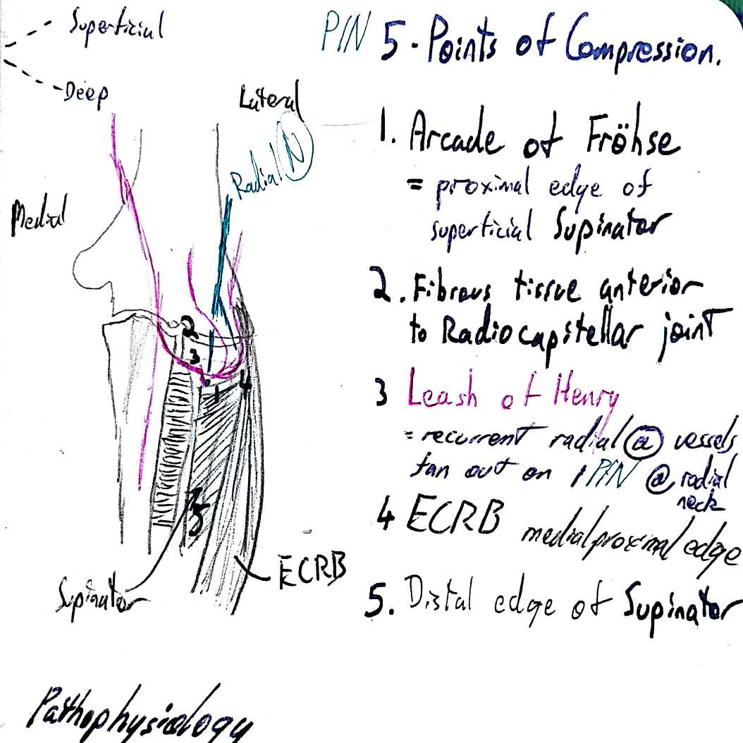 Posterior Interosseous Nerve