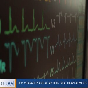 How wearables and AI can help treat heart ailments